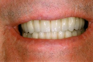 macromodelo-of-teeth-1437437_1920